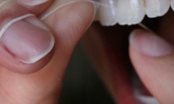 Hampaiden lankaus – 5 usein kysyttyä kysymystä
