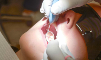Miksi hammastarkastuksessa käynti on tärkeää?